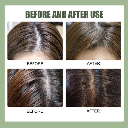 Centella Asiatica Sea Salt Shampoo Oil Dandruff Scalp Care