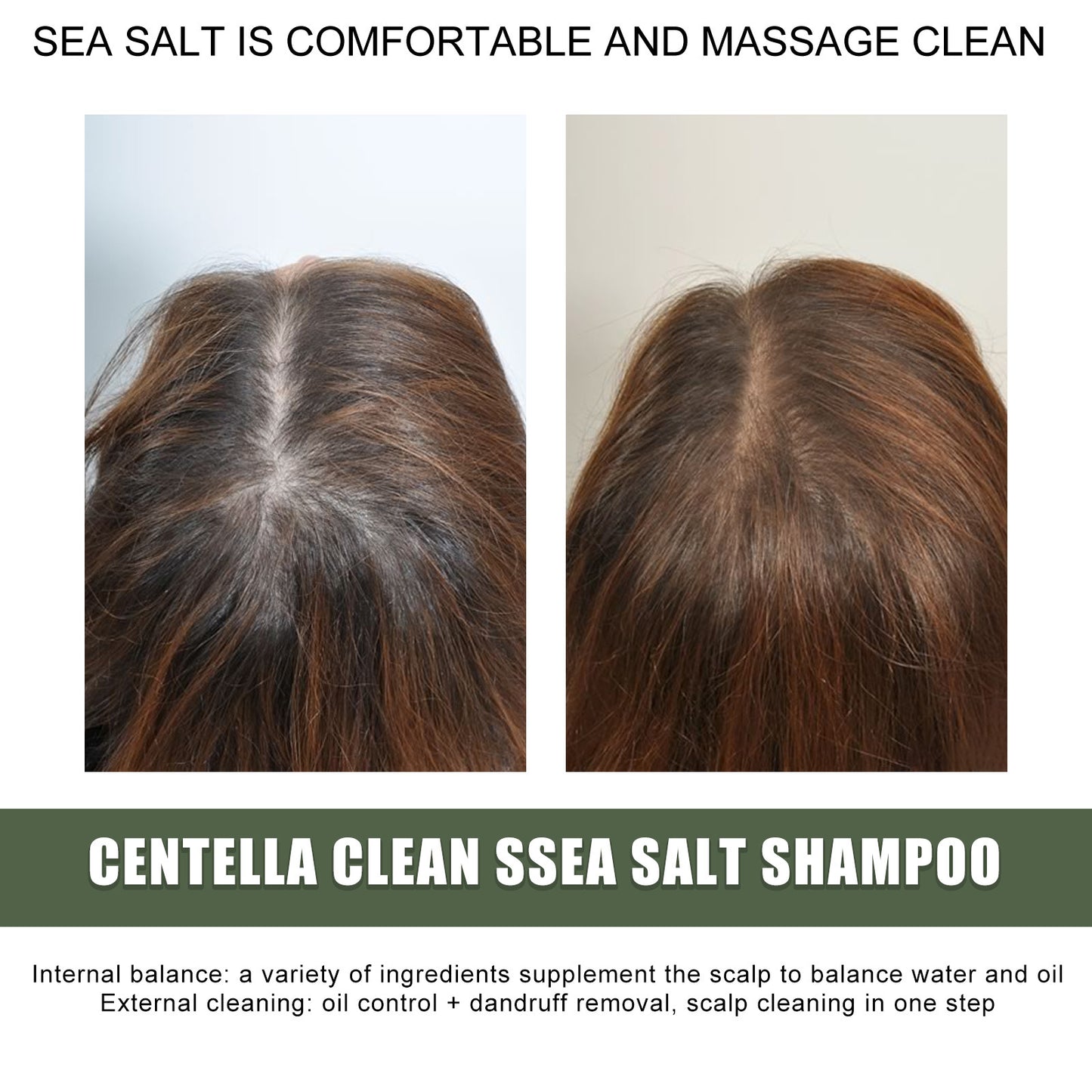 Centella Asiatica Sea Salt Shampoo Oil Dandruff Scalp Care